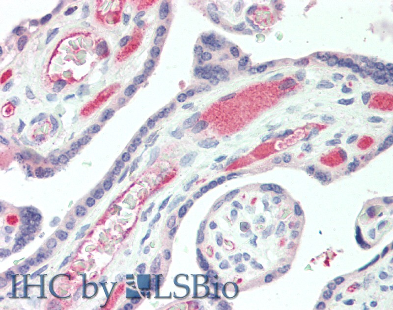 Immunohistochemistry of paraffin-embedded Human Placenta using IBSP Polyclonal Antibody at dilution of 1:50(Elabscience Product Detected by Lifespan).