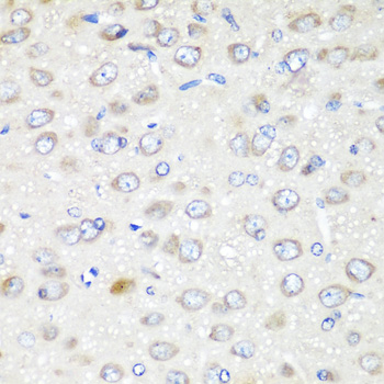 Immunohistochemistry of paraffin-embedded rat brain using GABARAPL2 Polyclonal Antibody at dilution of 1:200 (40x lens).Perform microwave antigen retrieval with 10 mM PBS buffer pH 7.2 before commencing with IHC staining protocol.