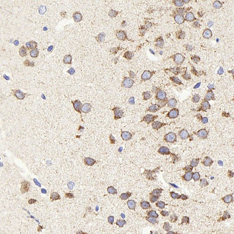 Immunohistochemistry analysis of paraffin-embedded Rat brain  using beta Amyloid Polyclonal Antibody at dilution of 1:300.