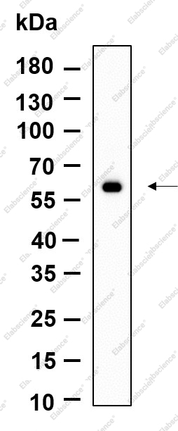 Recombinant PAKγ Monoclonal Antibody - 1