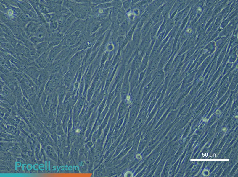 Human Dermal Fibroblast (Primary cell immortalization) Complete Medium - 5