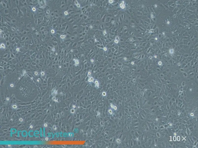 HuCC-T1 Cell Complete Medium - 1