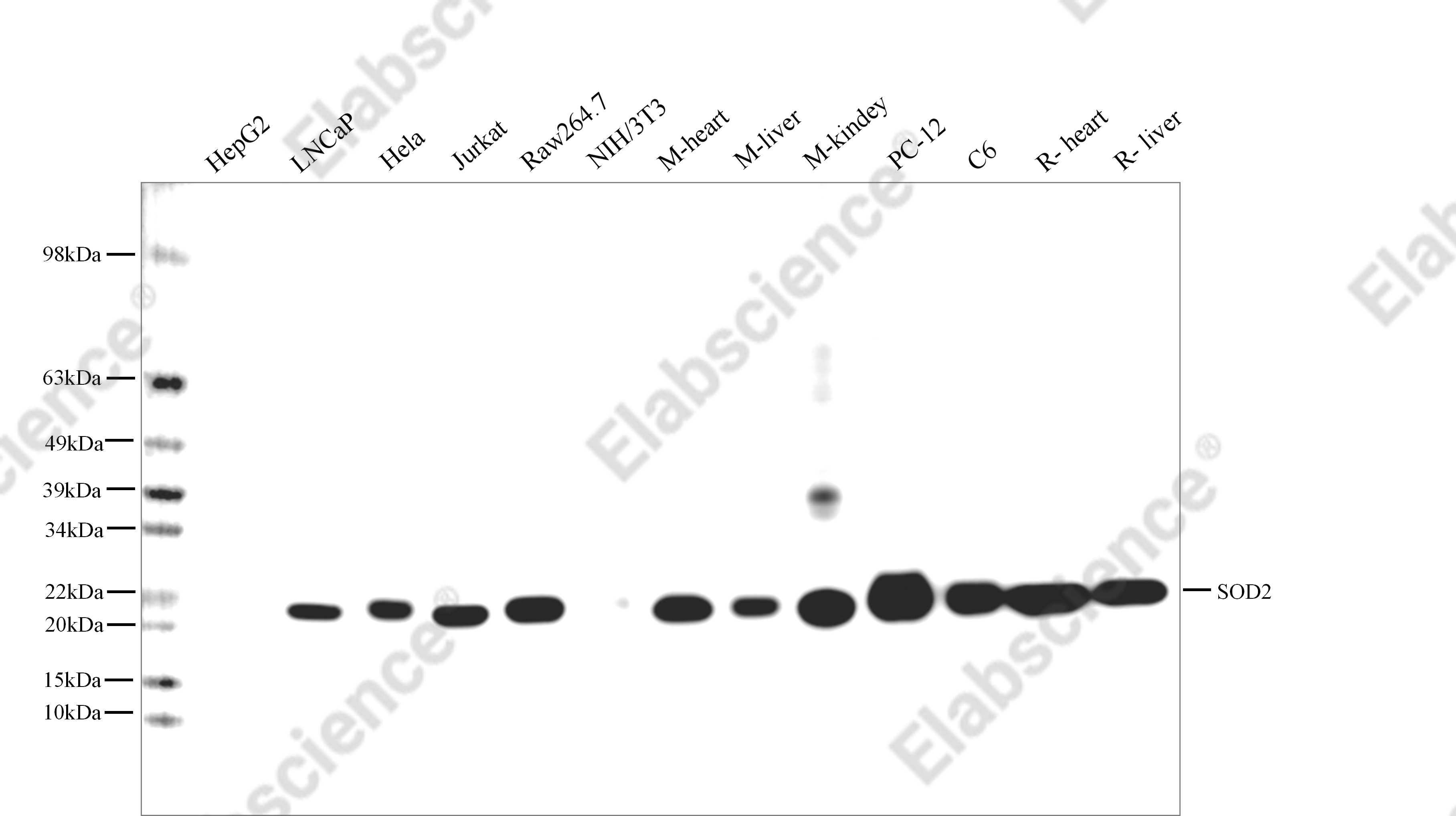 Recombinant SOD2 Monoclonal Antibody - 4