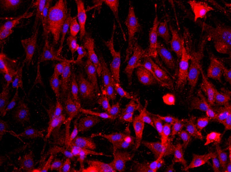 Rat Cavernous Endothelial Cell Complete Medium - 2