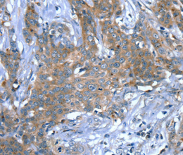 SCPEP1 Polyclonal Antibody - 2