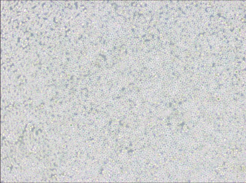 MEL Cell Complete MediumMEL Cell Complete Medium - 2