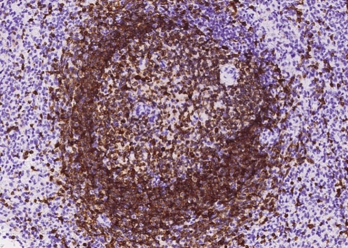 Recombinant CD79A/Ig-alpha Monoclonal Antibody - small - 4