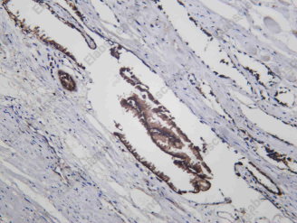 Recombinant STX17 Monoclonal Antibody - 2