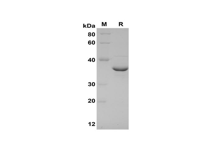 Recombinant Mouse ALCAM/CD166 Protein(His Tag)-产品推荐-1