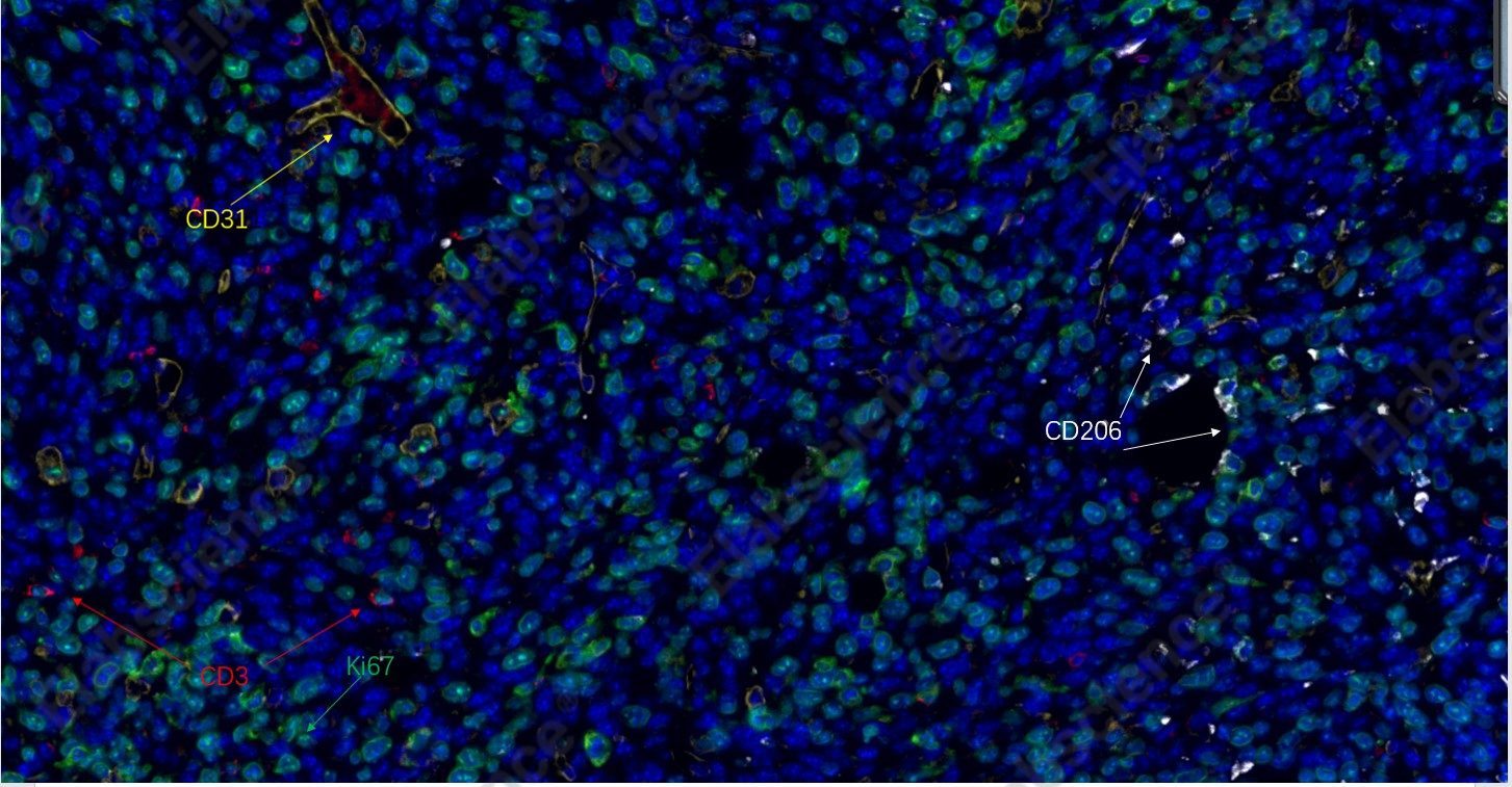 Recombinant CD31 Monoclonal Antibody - 7