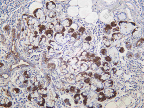 Recombinant GCDFP-15 Monoclonal Antibody - 1