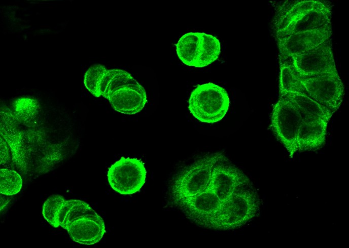 Recombinant ORP150/ORP150/HYOU1/HSP12A Monoclonal Antibody - small - 5