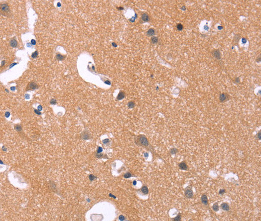 Immunohistochemistry of paraffin-embedded Human brain  using MAPK11  Polyclonal Antibody at dilution of 1:30