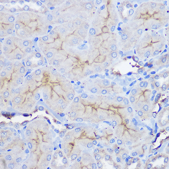 Immunohistochemistry of paraffin-embedded rat kidney using CD73/NT5E Polyclonal Antibody at dilution of 1:100 (40x lens).Perform microwave antigen retrieval with 10 mM PBS buffer pH 7.2 before commencing with IHC staining protocol.