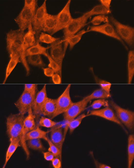 Immunofluorescence analysis of NIH-3T3 cells using PFKM Polyclonal antibody at dilution of 1:100 (40x lens). Blue: DAPI for nuclear staining.