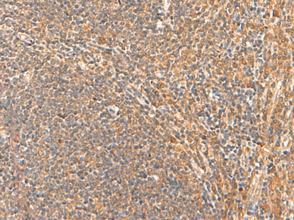 Immunohistochemistry of paraffin-embedded Human tonsil tissue  using HPCA Polyclonal Antibody at dilution of 1:55(?200)