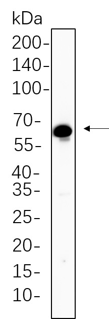 Recombinant TGF β Receptor II Monoclonal Antibody-searchlist-1