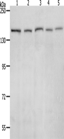 Western Blot analysis of 293T, Hela, K562, NIH/3T3 and RAW264.7 cell using RAD50 Polyclonal Antibody at dilution of 1:900