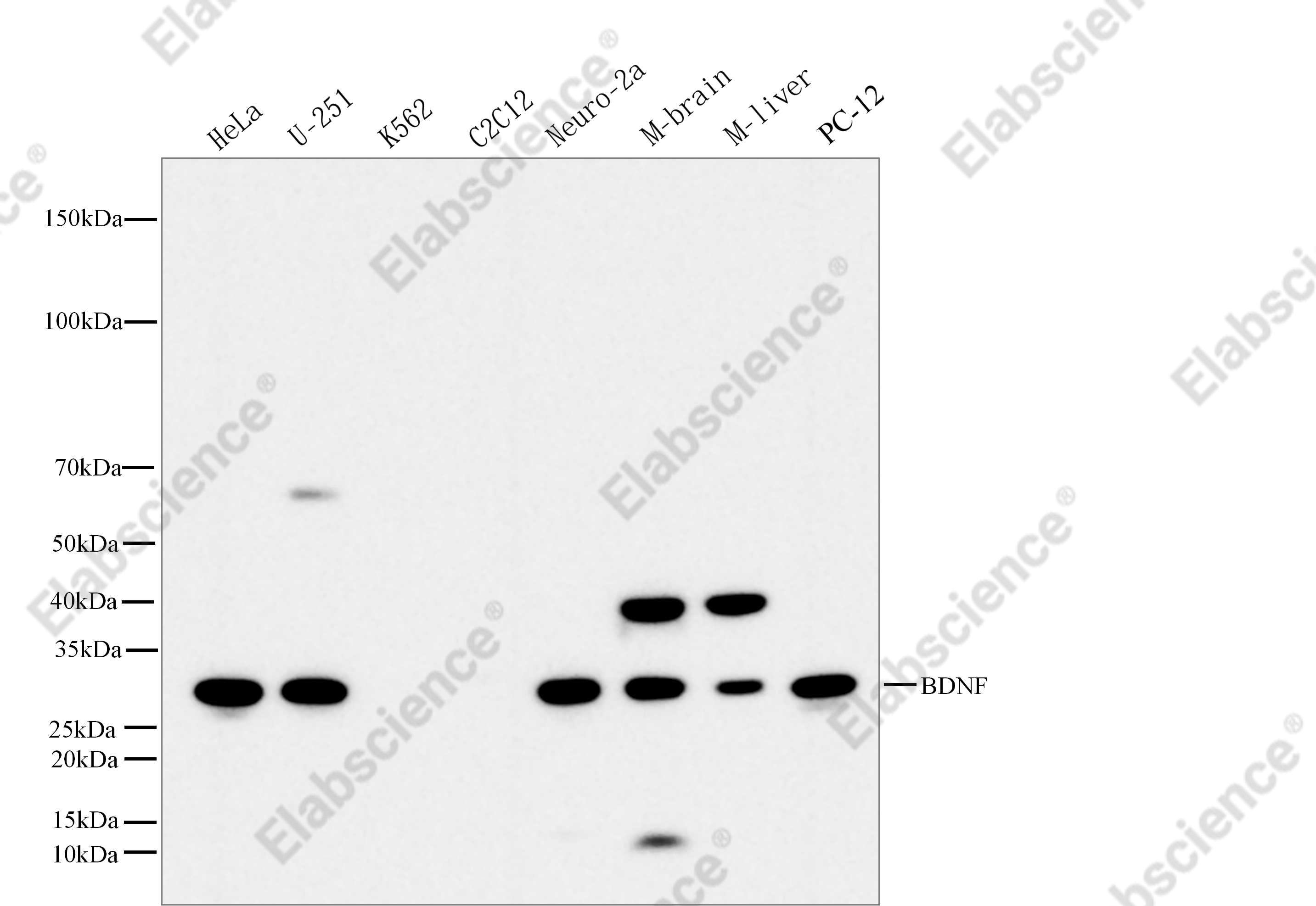 Recombinant BDNF Monoclonal Antibody - 1