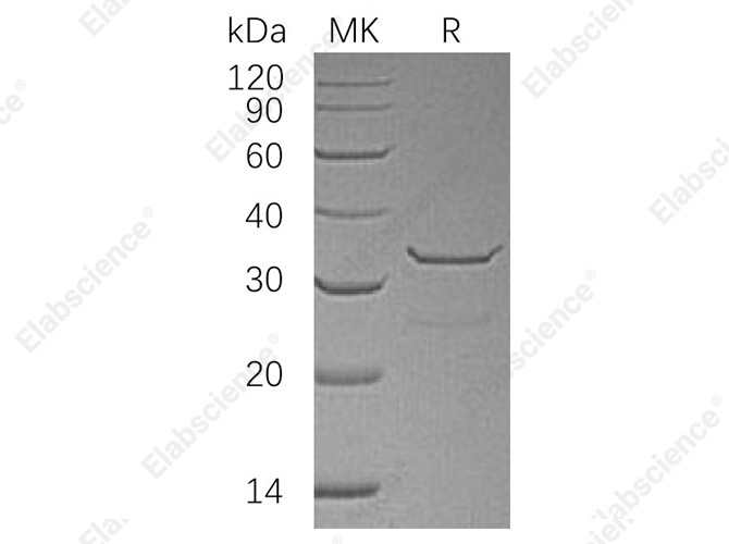 Recombinant Human SULT1B1 Protein (His Tag) - 1