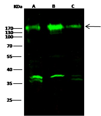 Recombinant Nicastrin/NCSTN Monoclonal Antibody-searchlist-1