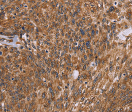 PPIB Polyclonal Antibody - 2