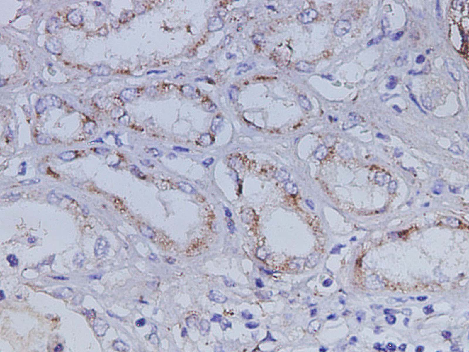 Purified Anti-Human IgM Antibody[MHM-88]-产品推荐-1