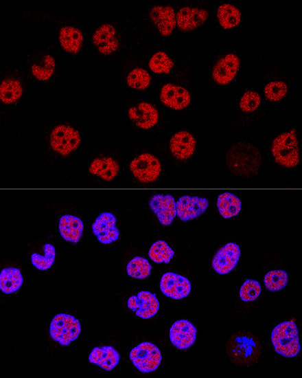 Confocal immunofluorescence analysis of Hela cells using KDM1 Polyclonal Antibody at dilution of 1:200. Blue: DAPI for nuclear staining.