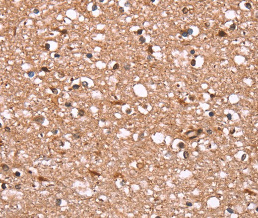 Immunohistochemistry of paraffin-embedded Human brain  tissue using FBXO31 Polyclonal Antibody at dilution 1:40