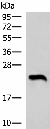 Western blot analysis of Human heart tissue lysate  using NEUROG3 Polyclonal Antibody at dilution of 1:1000