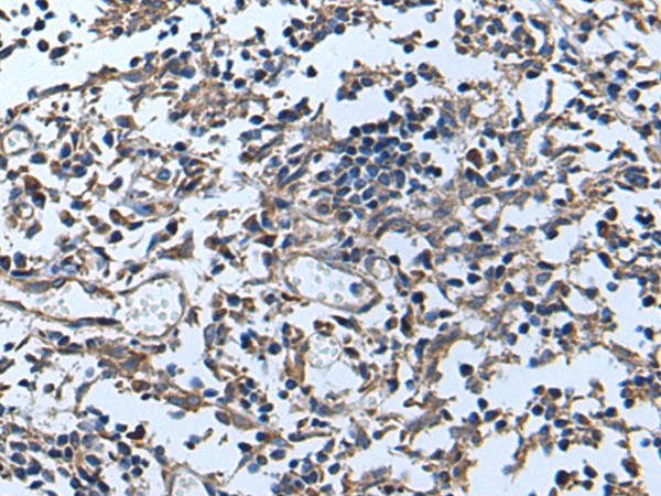 Immunohistochemistry of paraffin-embedded Human tonsil tissue  using APOD Polyclonal Antibody at dilution of 1:55(?200)