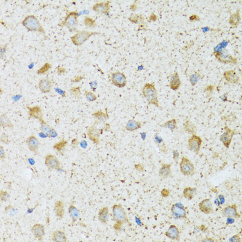 Immunohistochemistry of paraffin-embedded rat brain using COG2 Polyclonal Antibody at dilution of 1:100 (40x lens).Perform microwave antigen retrieval with 10 mM PBS buffer pH 7.2 before commencing with IHC staining protocol.