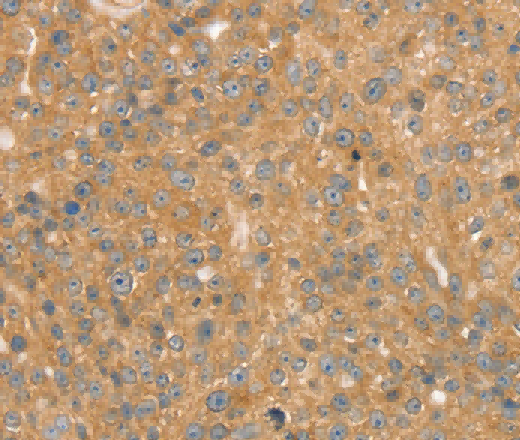 SNX2 Polyclonal Antibody - 3