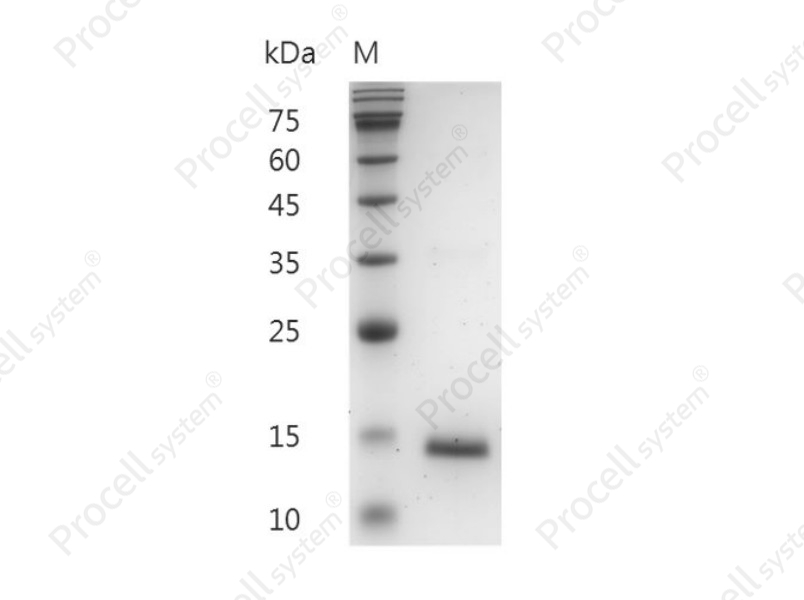 GM-CSF/CSF2/MGI-I/MGI-IGM, Mouse, Recombinant