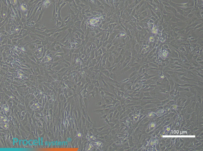 Rat Synovial Fibroblast Complete Medium - 1