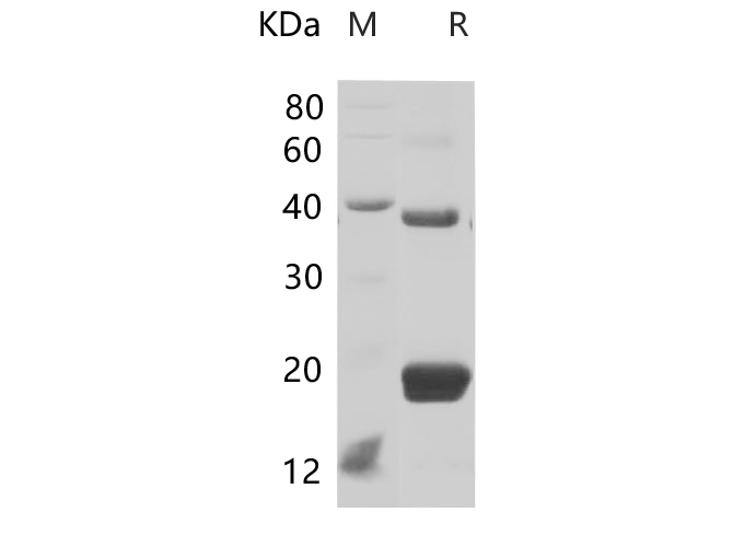 Recombinant Human CD38/SCARB3 Protein(His Tag)-产品推荐-1
