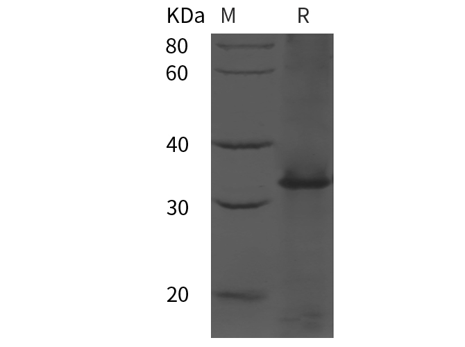 Recombinant Human IL7R/IL-7R/CD127 Protein(His Tag)-1