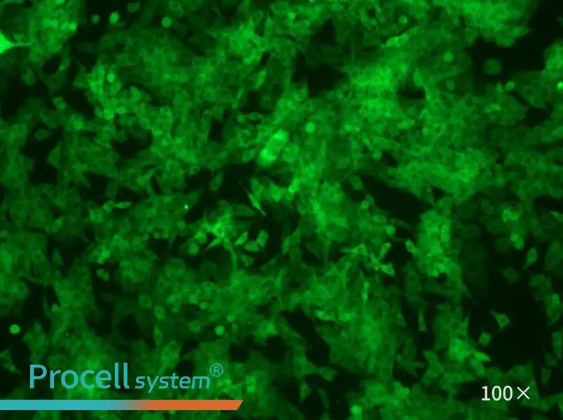 Panc02-GFPPanc02-GFP - 3