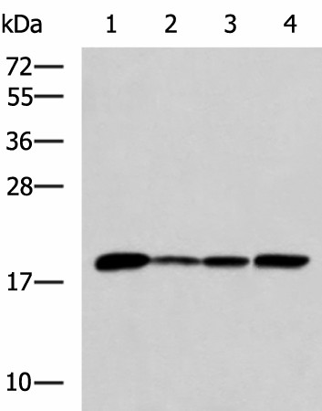 Western blot analysis of K562 Jurkat HepG2 cell Human fetal intestines tissue lysates  using AK6 Polyclonal Antibody at dilution of 1:800