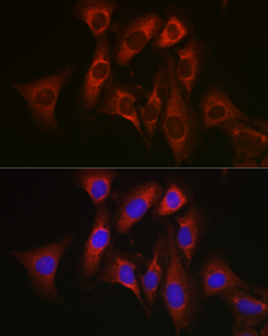 Immunofluorescence analysis of U2OS cells using Bcl-2 Polyclonal Antibody at dilution of 1:200. Blue: DAPI for nuclear staining.