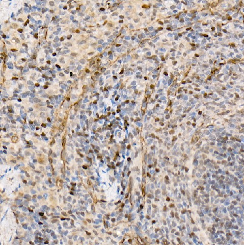 Immunohistochemistry of paraffin-embedded rat spleen using SETMAR Polyclonal Antibody at dilution of 1:100 (40x lens).Perform high pressure antigen retrieval with 10 mM citrate buffer pH 6.0 before commencing with IHC staining protocol.