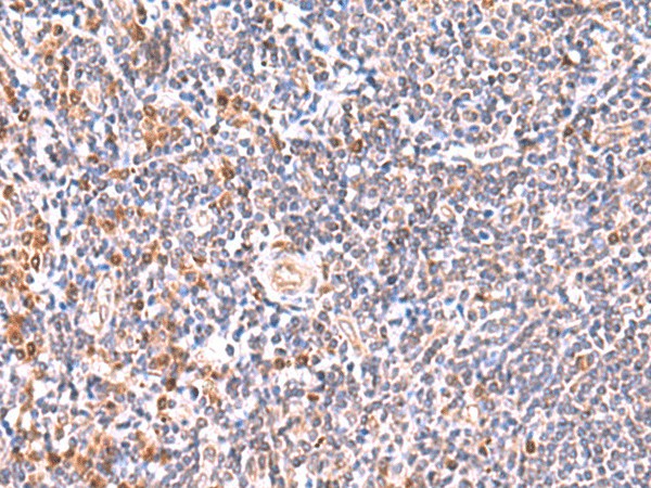 Immunohistochemistry of paraffin-embedded Human tonsil tissue  using GMDS Polyclonal Antibody at dilution of 1:55(?200)