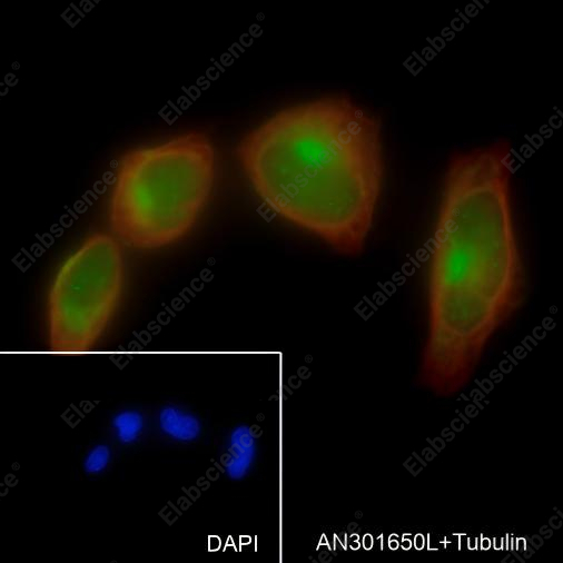 Recombinant S100A13 Monoclonal Antibody - 2