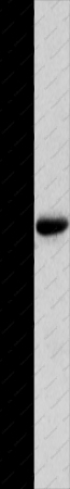 MYOZ1 Polyclonal Antibody - 1