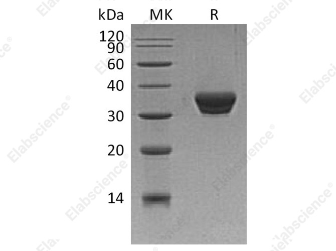 Recombinant Human ASAM Protein (His Tag) - 1