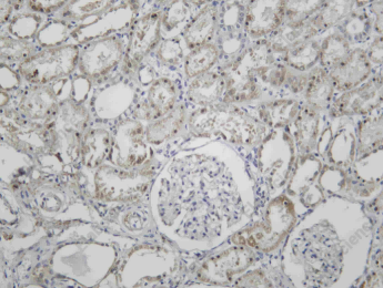 Recombinant IGF2-BP2 Monoclonal Antibody - 1