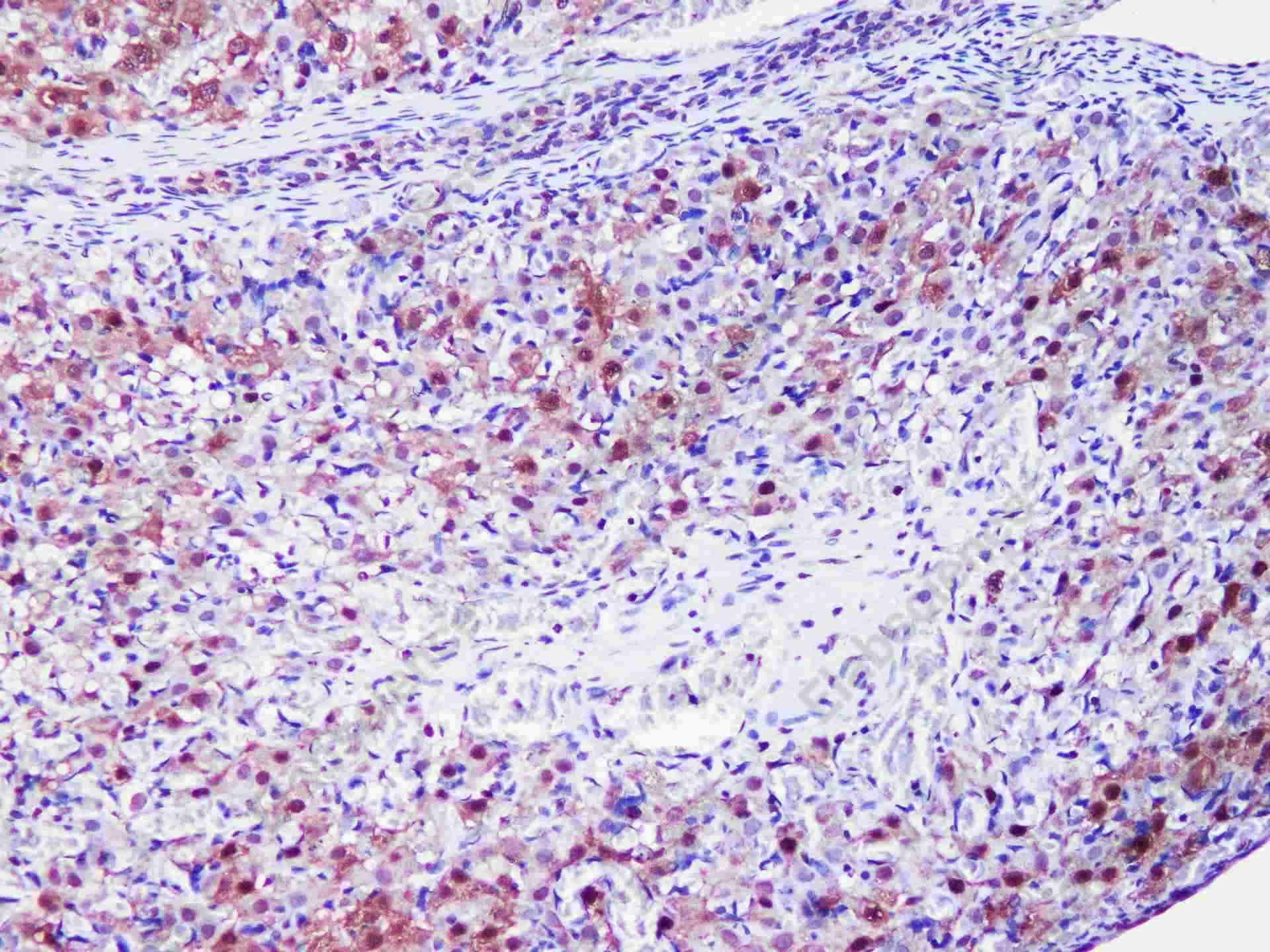 GAPDH Monoclonal Antibody - 4
