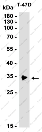 Recombinant IGFBP2 Monoclonal Antibody - 1