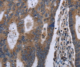 GSTA3 Polyclonal Antibody - 2