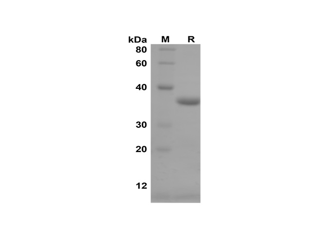Recombinant Mouse TNF-α Protein(GST Tag)-产品推荐-1